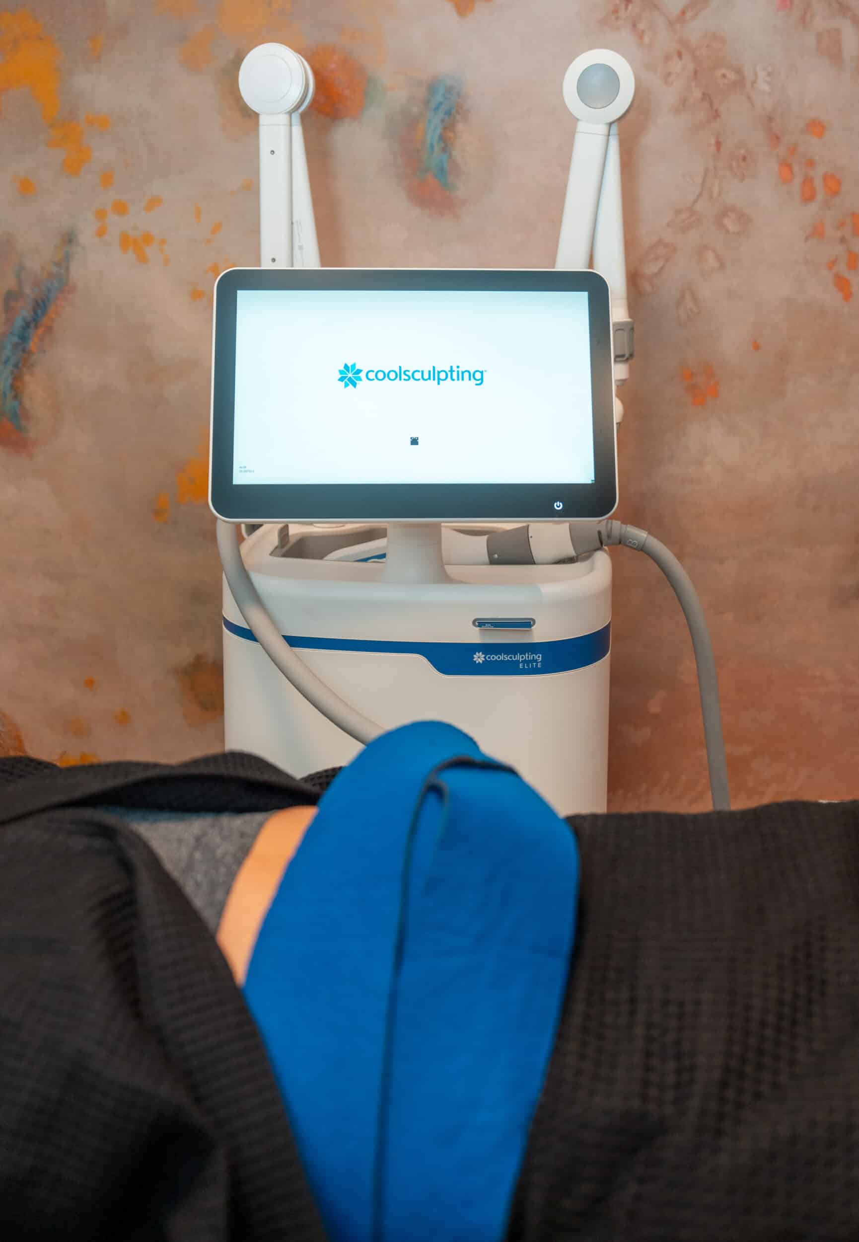 Coolsculpting