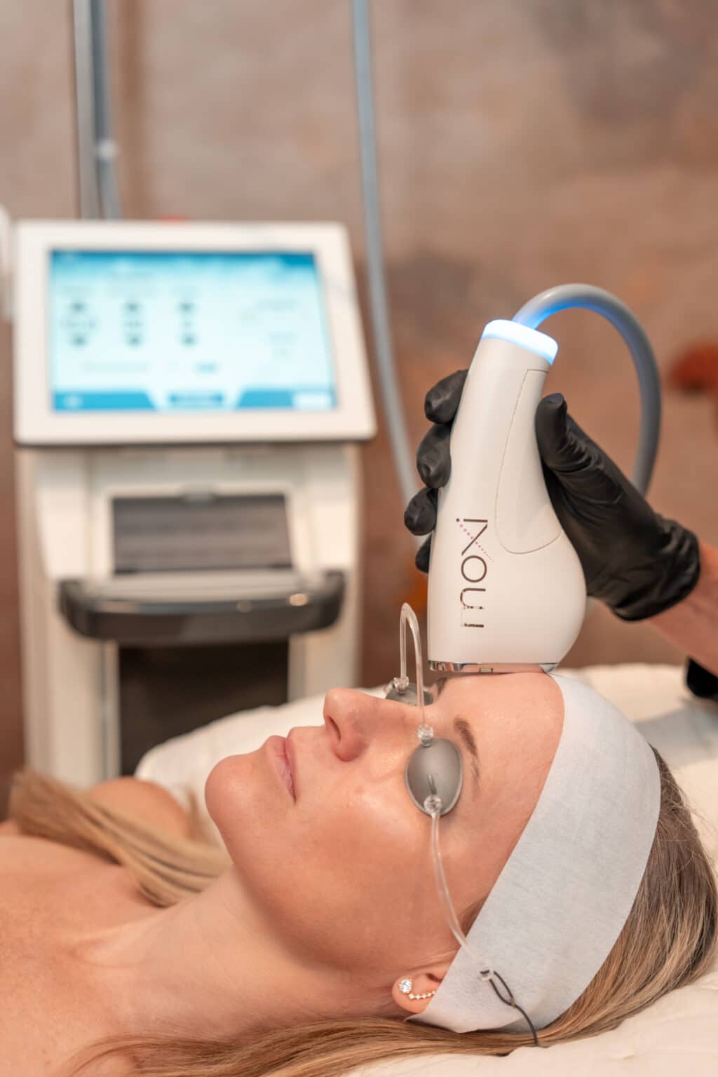 MOXI Laser Treatment Aspen CO - Lunchtime Treatment Basalt