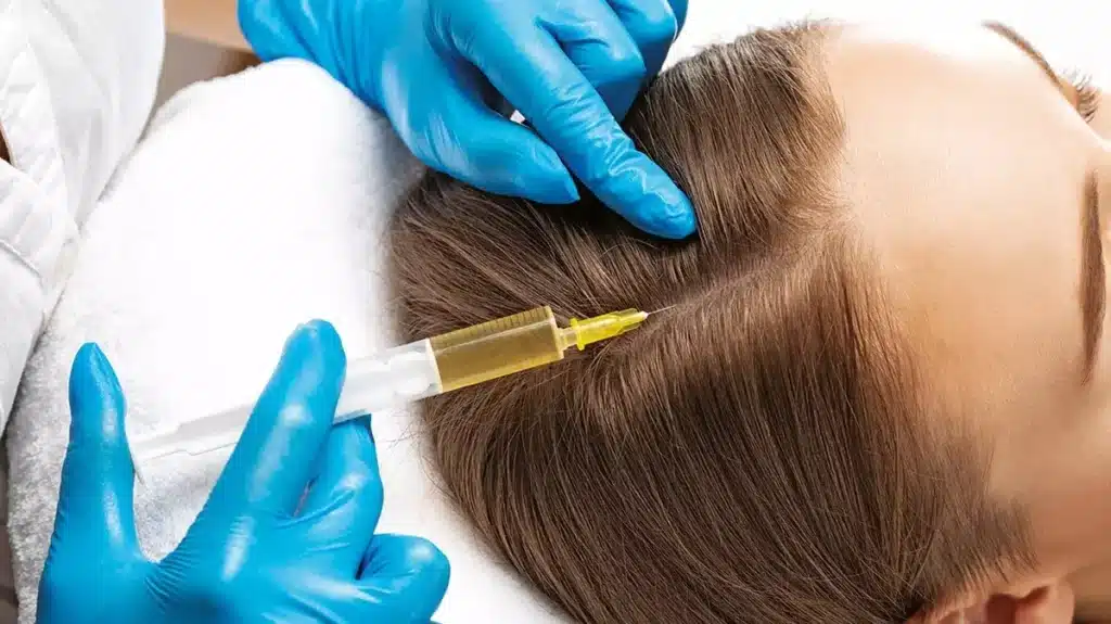 Woman receives PRP injection into her scalp to re-stimulate hair growth.