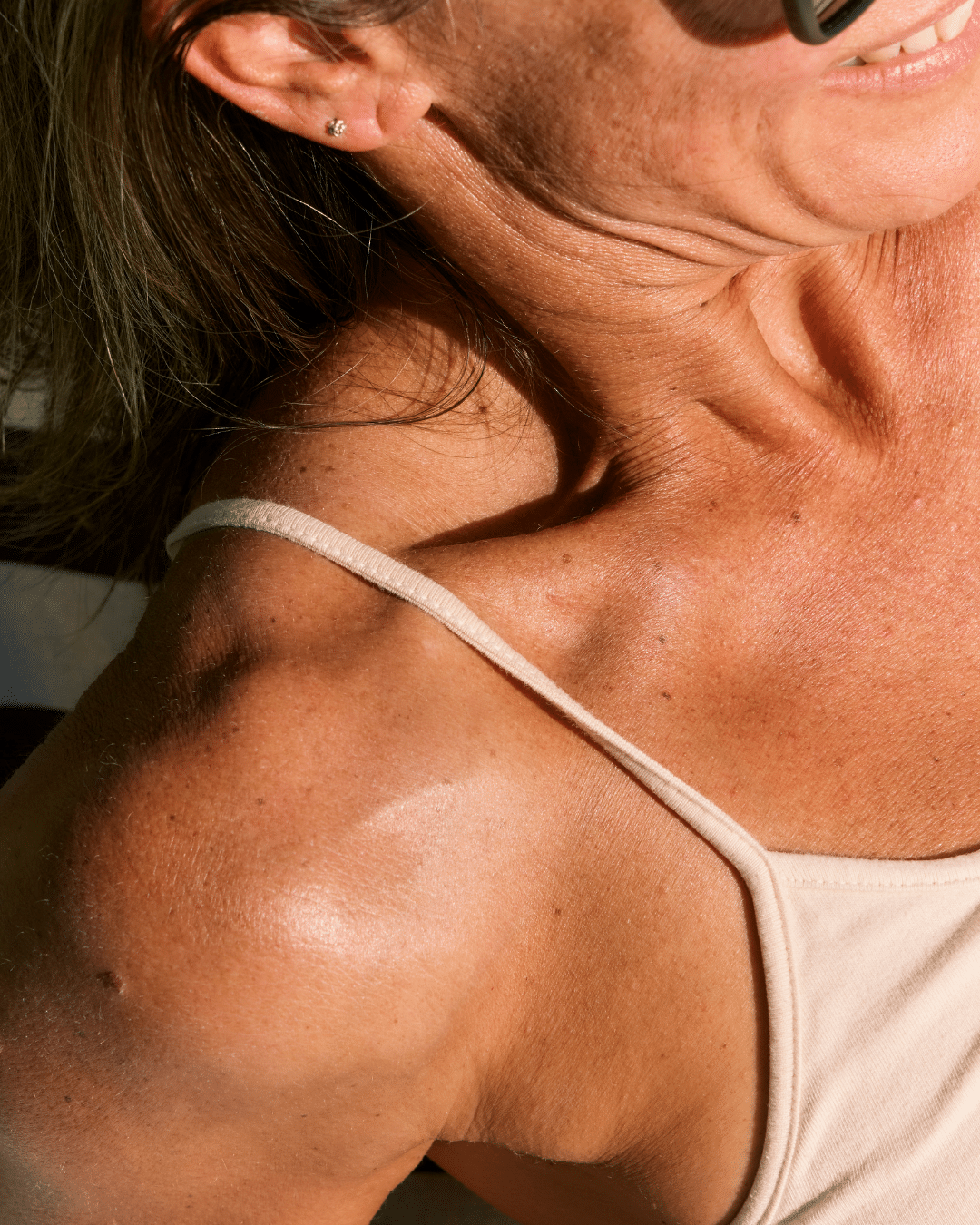 menopause skin changes